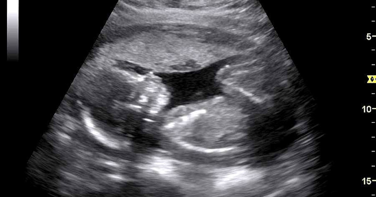 The fake sonogram will make your buddies talk post thumbnail image