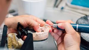 Crafting Confidence: The Artistry of Dental Lab Technology post thumbnail image